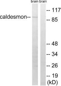 Western blot analysis of lysates from mouse brain using Anti-Caldesmon Antibody. The right hand lane represents a negative control, where the antibody is blocked by the immunising peptide.