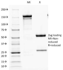 SDS-PAGE analysis of Anti-Parathyroid Hormone Antibody [PTH/1173] under non-reduced and reduced conditions; showing intact IgG and intact heavy and light chains, respectively. SDS-PAGE analysis confirms the integrity and purity of the antibody