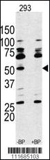 Anti-S6K (RPS6KB1) Rabbit Polyclonal Antibody