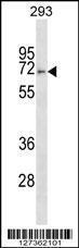 Anti-FBXO46 Rabbit Polyclonal Antibody (Biotin)