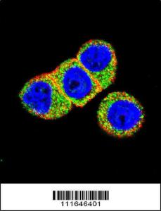 Anti-AKT2 Rabbit Polyclonal Antibody (AP (Alkaline Phosphatase))