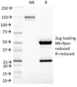 SDS-PAGE analysis of Anti-Kappa Light Chain Antibody [KLC1278] under non-reduced and reduced conditions; showing intact IgG and intact heavy and light chains, respectively. SDS-PAGE analysis confirms the integrity and purity of the antibody.