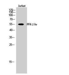 Antibody anti-PFKFB1 100 µg