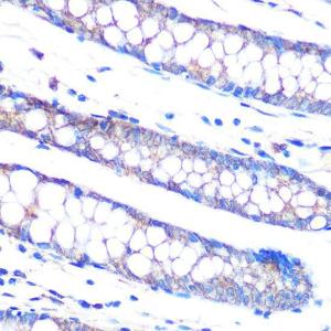 Immunohistochemistry analysis of paraffin-embedded human colon tissue using Anti-DUSP6 Antibody [ARC0237] (A305412) at a dilution of 1:100 (40X lens). Perform microwave antigen retrieval with 10 mM PBS buffer pH 7.2 before commencing with IHC staining protocol