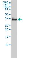 Anti-NPM Mouse Monoclonal Antibody [clone: 3B2]