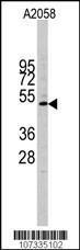 Anti-CCNE1 Rabbit Polyclonal Antibody (APC (Allophycocyanin))