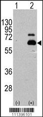 Anti-S6K (RPS6KB1) Rabbit Polyclonal Antibody