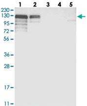 Anti-NHSL1 Rabbit Polyclonal Antibody