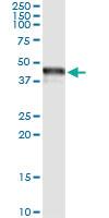 Anti-TRIB3 Mouse Monoclonal Antibody [clone: 3D7]