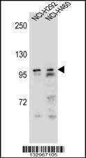 Anti-AR Rabbit Polyclonal Antibody