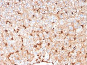 Immunohistochemical analysis of formalin-fixed, paraffin-embedded human liver using Anti-Apolipoprotein D Antibody [APOD/3414]