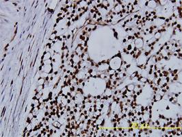 Anti-NPM Mouse Monoclonal Antibody [clone: 3B2]