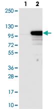 Anti-EXOC6 Rabbit Polyclonal Antibody