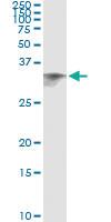 Anti-CIDEA Antibody Pair