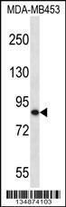 Anti-OTU7B Rabbit Polyclonal Antibody (Biotin)