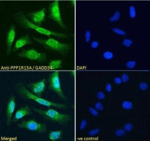 Anti-PPP1R15A Antibody (A83758) Immunofluorescence analysis of paraformaldehyde fixed HeLa cells, permeabilized with 0