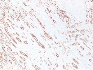 Immunohistochemical analysis of paraffin-embedded human Kidney using Anti-Cytokeratin 19 Antibody