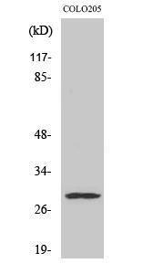 Western blot analysis of various cells using Anti-PEX11B Antibody