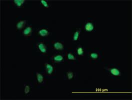 Anti-NPM Mouse Monoclonal Antibody [clone: 3B2]