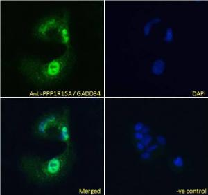 Anti-PPP1R15A Antibody (A83758) Immunofluorescence analysis of paraformaldehyde fixed HepG2 cells, permeabilized with 0