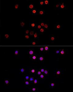 Immunofluorescence analysis of THP-1 cells using Anti-YKL-40 / CHI3L1 Antibody (A309216) at a dilution of 1:100 (40x lens). DAPI was used to stain the cell nuclei (blue)