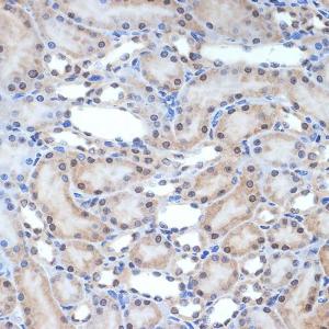 Immunohistochemistry analysis of paraffin-embedded rat kidney using Anti-XPD Antibody [ARC2401] (A305413) at a dilution of 1:100 (40x lens) Perform microwave antigen retrieval with 10 mM Tris/EDTA buffer pH 90 before commencing with IHC staining protocol