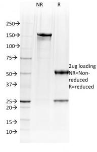 SDS-PAGE analysis of Anti-BOB1 Antibody [BOB1/2423] under non-reduced and reduced conditions; showing intact IgG and intact heavy and light chains, respectively. SDS-PAGE analysis confirms the integrity and purity of the antibody