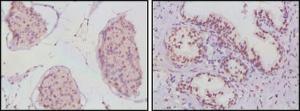 Anti-AR Mouse monoclonal antibody unconjugated [clone: 2H8]