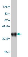 Anti-TRIB3 Mouse Monoclonal Antibody [clone: 2F7]