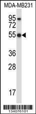 Anti-HCLS1 Rabbit Polyclonal Antibody (PE (Phycoerythrin))