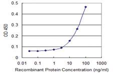 Anti-TRIB3 Mouse Monoclonal Antibody [clone: 3D7]