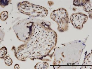 Anti-ZSCAN29 Mouse Monoclonal Antibody [clone: 2E8]