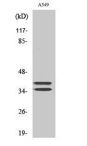 Western blot analysis of various cells using Anti-LAT Antibody