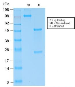 Anti-Kappa Light Chain Rabbit Recombinant Antibody [clone: KLC2289R]