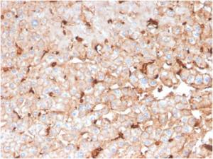 Immunohistochemical analysis of formalin-fixed, paraffin-embedded human liver using Anti-Apolipoprotein D Antibody [APOD/3414]