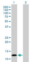 Anti-NPPB Rabbit Polyclonal Antibody