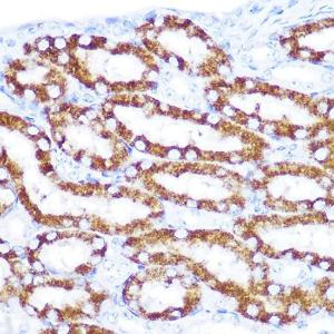 Immunohistochemistry analysis of paraffin-embedded mouse kidney using Anti-DcR2 Antibody (A9798) at a dilution of 1:100 (40X lens). Perform microwave antigen retrieval with 10 mM Tris/EDTA buffer pH 9.0 before commencing with IHC staining protocol