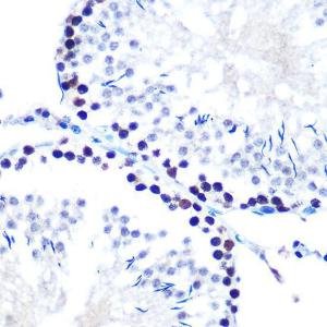 Immunohistochemistry analysis of paraffin-embedded rat testis using Anti-mSin3A Antibody [ARC0745] (A309217) at a dilution of 1:100 (40X lens). Perform microwave antigen retrieval with 10 mM PBS buffer pH 7.2 before commencing with IHC staining protocol