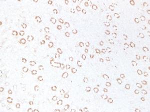 Immunohistochemical analysis of paraffin-embedded human Kidney using Anti-Cytokeratin 19 Antibody