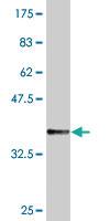 Anti-TAPBPL Mouse Monoclonal Antibody [clone: 6E3]