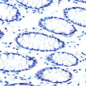 Immunohistochemistry analysis of paraffin-embedded human colon tissue using Anti-mSin3A Antibody [ARC0745] (A309217) at a dilution of 1:100 (40X lens). Perform microwave antigen retrieval with 10 mM PBS buffer pH 7.2 before commencing with IHC staining protocol