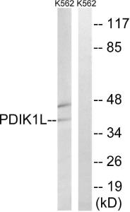 Western blot analysis of lysates from K562 cells using Anti-PDIK1L Antibody The right hand lane represents a negative control, where the antibody is blocked by the immunising peptide