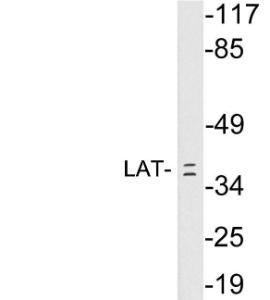 Western blot analysis of lysates from Jurkat cells using Anti-LAT Antibody