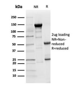 SDS-PAGE analysis of Anti-LY75 Antibody [CD205/3720] under non-reduced and reduced conditions; showing intact IgG and intact heavy and light chains, respectively SDS-PAGE analysis confirms the integrity and purity of the antibody