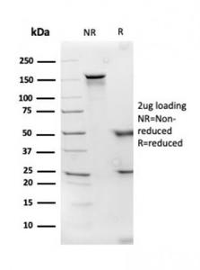 SDS-PAGE analysis of Anti-Apolipoprotein D Antibody [APOD/3414] under non-reduced and reduced conditions; showing intact IgG and intact heavy and light chains, respectively. SDS-PAGE analysis confirms the integrity and purity of the antibody.