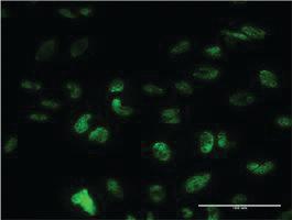 Anti-PUF60 Mouse Monoclonal Antibody [clone: 1C1]