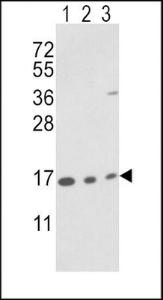 Anti-PPIA Rabbit Polyclonal Antibody