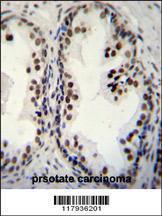 Anti-DDX27 Rabbit Polyclonal Antibody