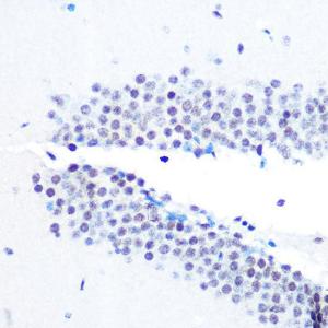 Immunohistochemistry analysis of paraffin-embedded mouse brain using Anti-mSin3A Antibody [ARC0745] (A309217) at a dilution of 1:100 (40X lens). Perform microwave antigen retrieval with 10 mM PBS buffer pH 7.2 before commencing with IHC staining protocol