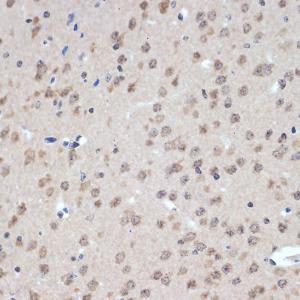 Immunohistochemistry analysis of paraffin-embedded mouse brain using Anti-XPD Antibody [ARC2401] (A305413) at a dilution of 1:100 (40x lens) Perform microwave antigen retrieval with 10 mM Tris/EDTA buffer pH 90 before commencing with IHC staining protocol